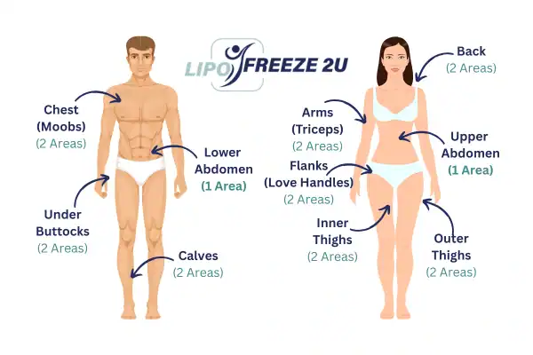Areas you can have fat freezing treatment Greenford