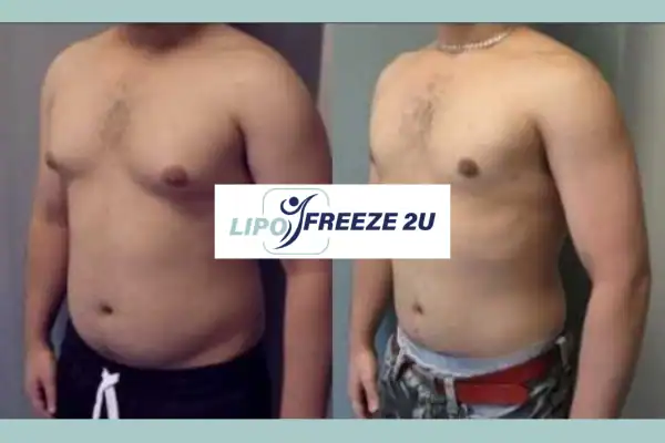 How Long Does It Take to See Results Greenford?