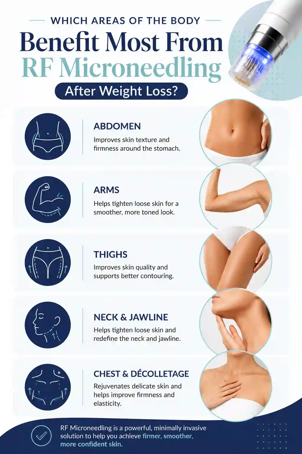 Which Areas of the Body Benefit Most From RF Microneedling After Weight Loss Greenford